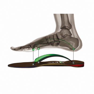 Foot with bones over the top of an orthotic
